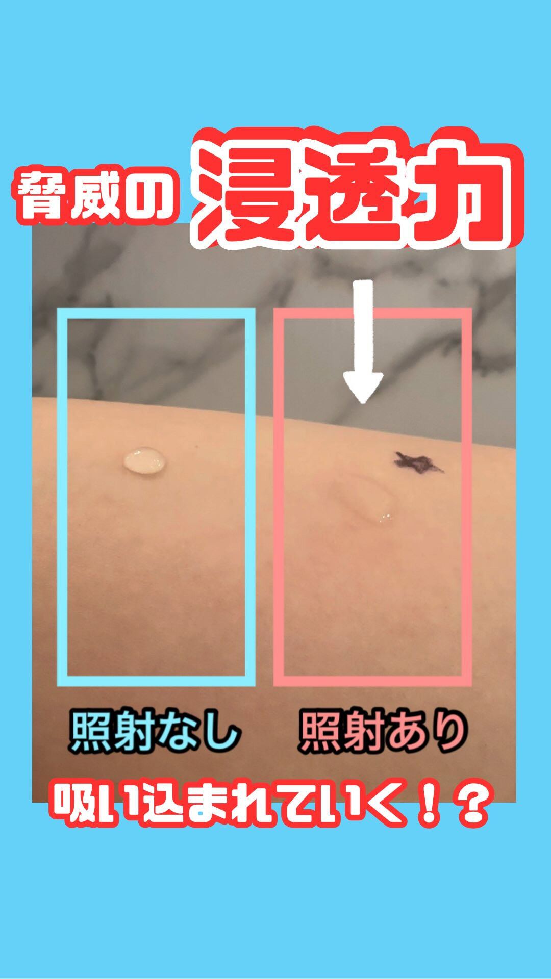 【⚡️プラズマフェイシャル⚡️】