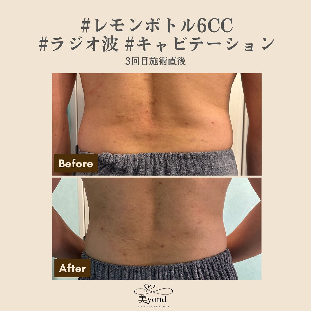 施術Before/After📷