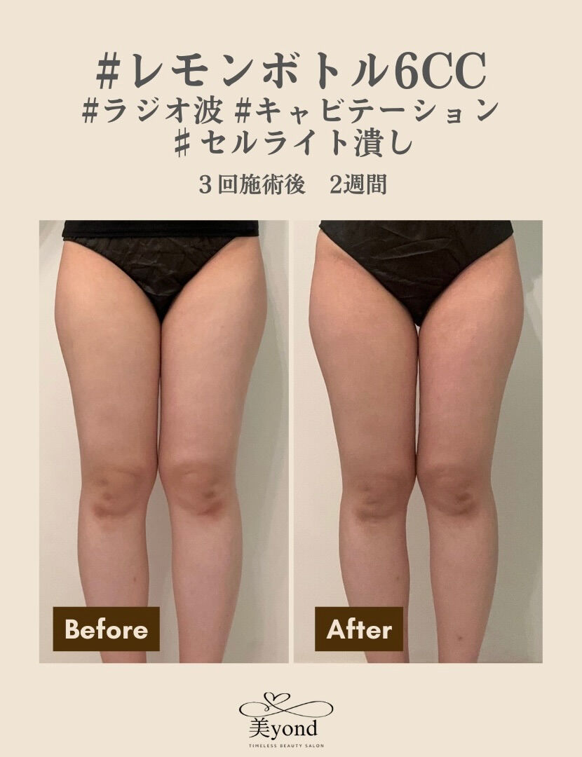 施術Before/After📷