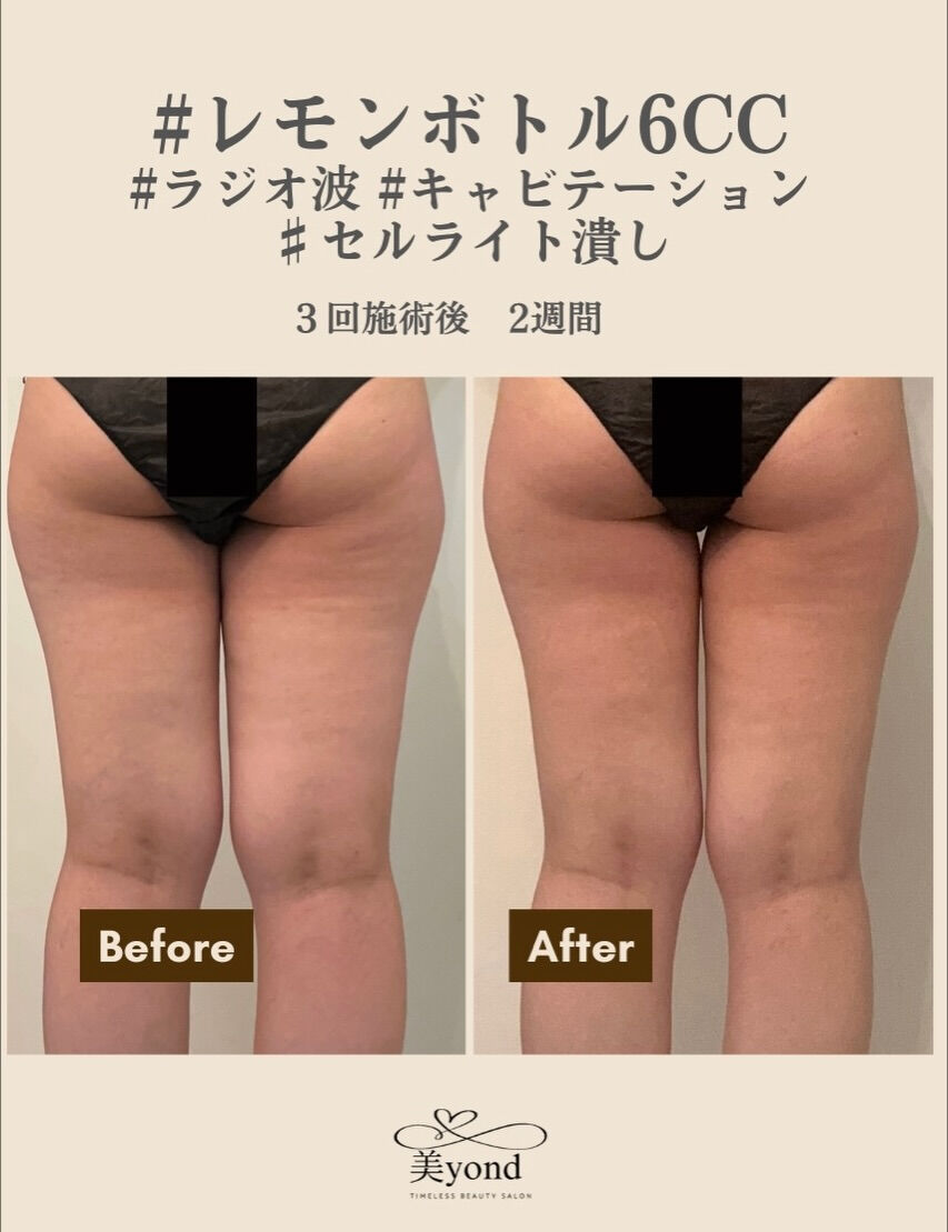 施術Before/After📷